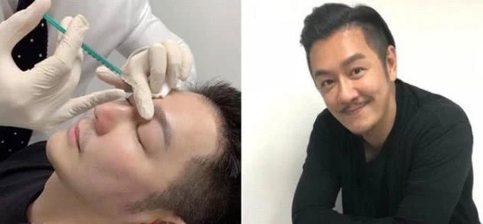 Lạm dụng dao kéo thẩm mỹ, gương mặt của Trần Hạo Dân ngày càng kỳ quặc - 7 Lạm dụng dao kéo thẩm mỹ, gương mặt của Trần Hạo Dân ngày càng kỳ quặc - 7