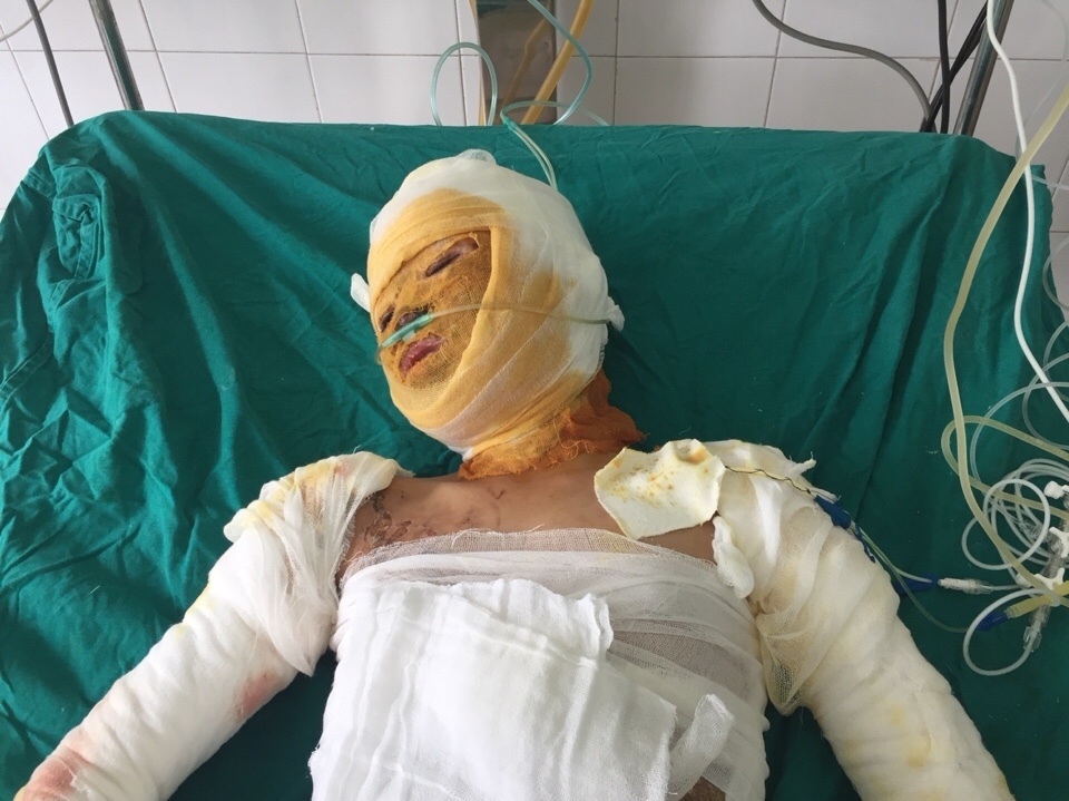Vụ cả nhà 4 người bị thiêu sống, chỉ còn cô bé 9 tuổi sống sót - 7 Vụ cả nhà 4 người bị thiêu sống, chỉ còn cô bé 9 tuổi sống sót - 7
