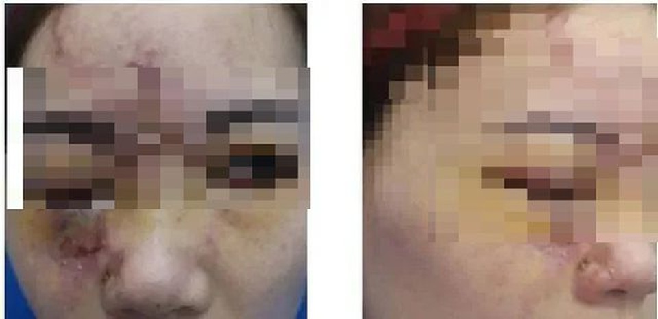 Bác sĩ phát sợ với xu hướng thẩm mỹ để lại di chứng cả đời của chị em - 1 Bác sĩ phát sợ với xu hướng thẩm mỹ để lại di chứng cả đời của chị em - 1