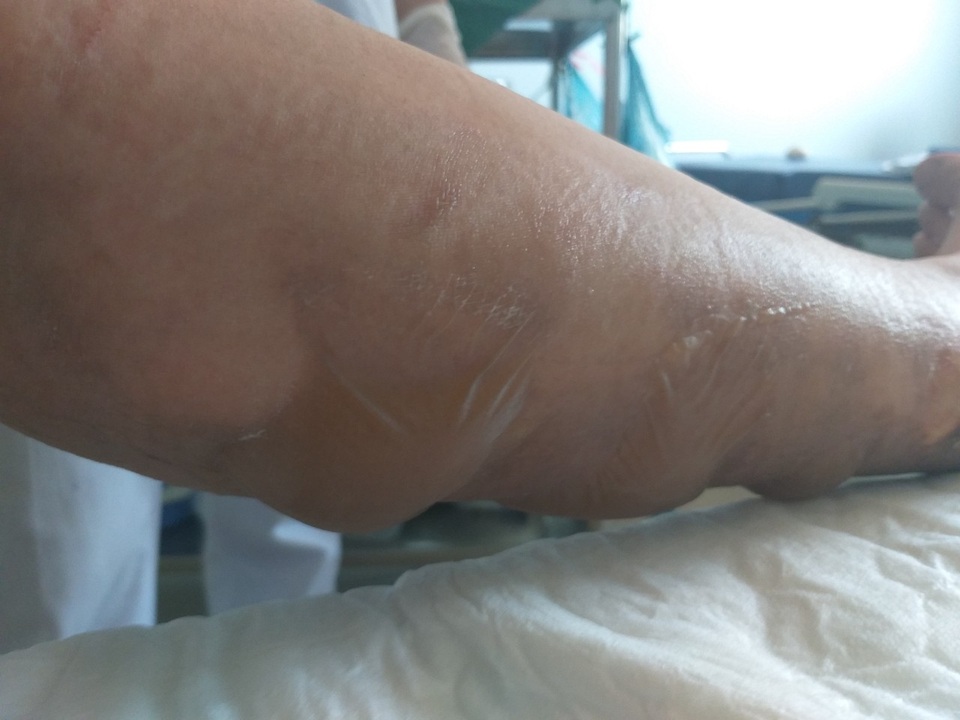 Kẻ lạ mặt ném “bom xăng” vào nhà người phụ nữ đơn thân - 6 Kẻ lạ mặt ném “bom xăng” vào nhà người phụ nữ đơn thân - 6