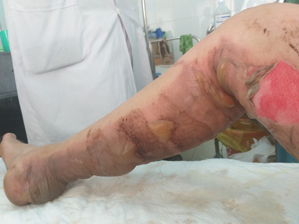 Vụ người phụ nữ bị ném “bom xăng”: Kẻ lạ mặt từng 2 lần đến đánh, đốt! - 4 Vụ người phụ nữ bị ném “bom xăng”: Kẻ lạ mặt từng 2 lần đến đánh, đốt! - 4