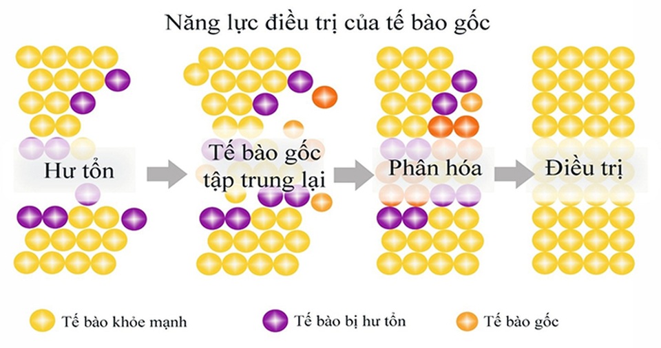 Dương Cẩm Lynh lần đầu chia sẻ bí quyết trẻ mãi không già - 4
