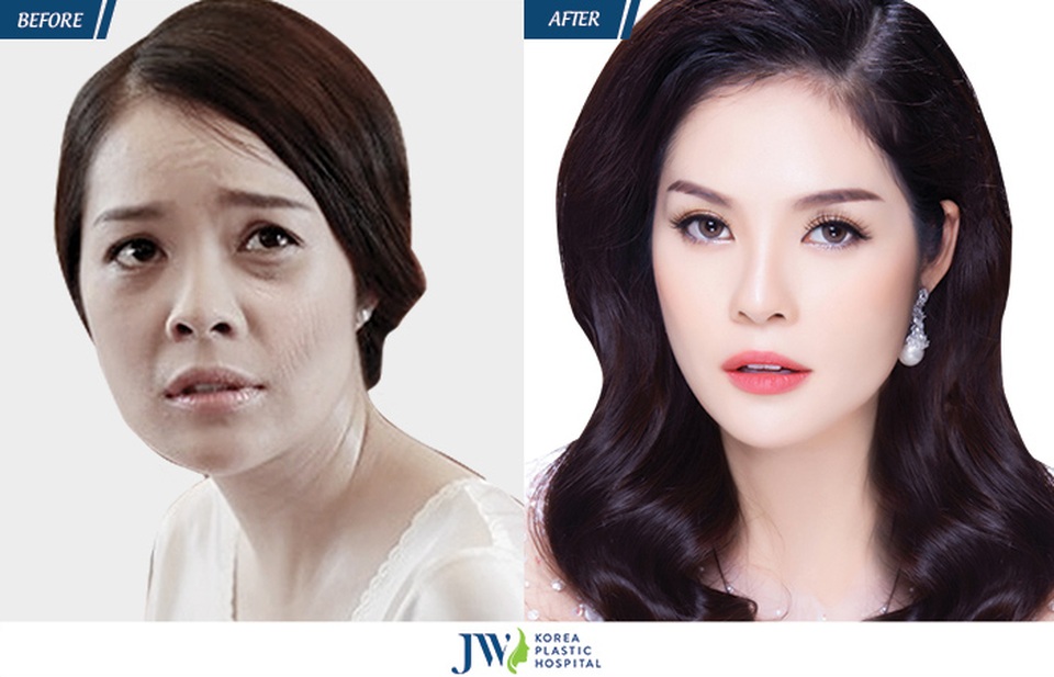 Dương Cẩm Lynh lần đầu chia sẻ bí quyết trẻ mãi không già - 5