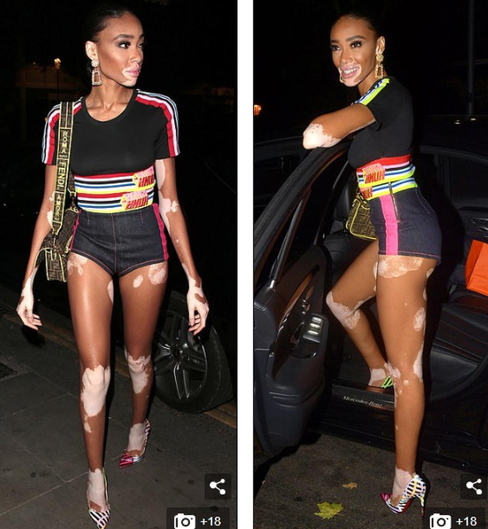 Winnie Harlow khoe dáng thon bốc lửa - 6 Winnie Harlow khoe dáng thon bốc lửa - 6
