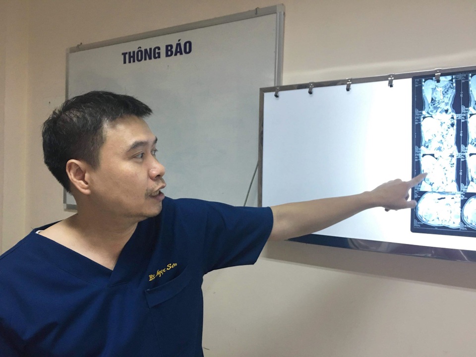 Bác sĩ phát hoảng vì... bệnh nhân hớn hở khoe tiểu ra sỏi dù chỉ uống thuốc lá  - 1