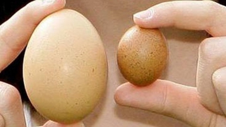 “Thủ phạm” gây lệch tinh hoàn - 1 “Thủ phạm” gây lệch tinh hoàn - 1