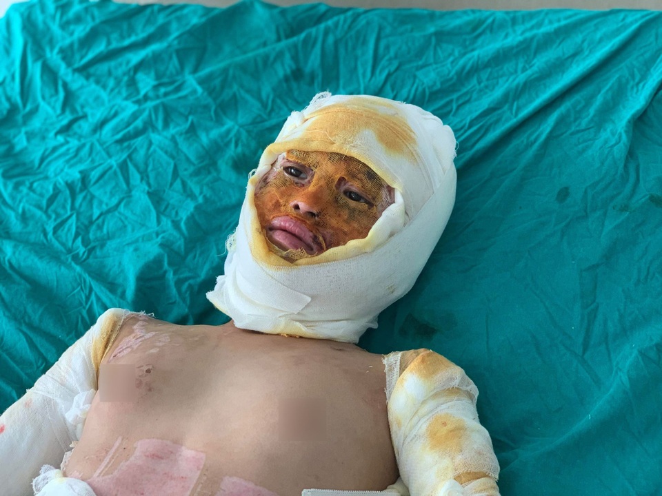 Bạn đọc Dân trí giúp đỡ bé gái sống sót duy nhất trong vụ cả nhà 4 người bị thiêu sống gần 180 triệu đồng - 1 Bạn đọc Dân trí giúp đỡ bé gái sống sót duy nhất trong vụ cả nhà 4 người bị thiêu sống gần 180 triệu đồng - 1