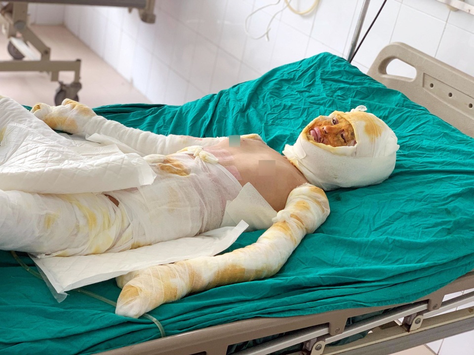 Bạn đọc Dân trí giúp đỡ bé gái sống sót duy nhất trong vụ cả nhà 4 người bị thiêu sống gần 180 triệu đồng - 3 Bạn đọc Dân trí giúp đỡ bé gái sống sót duy nhất trong vụ cả nhà 4 người bị thiêu sống gần 180 triệu đồng - 3