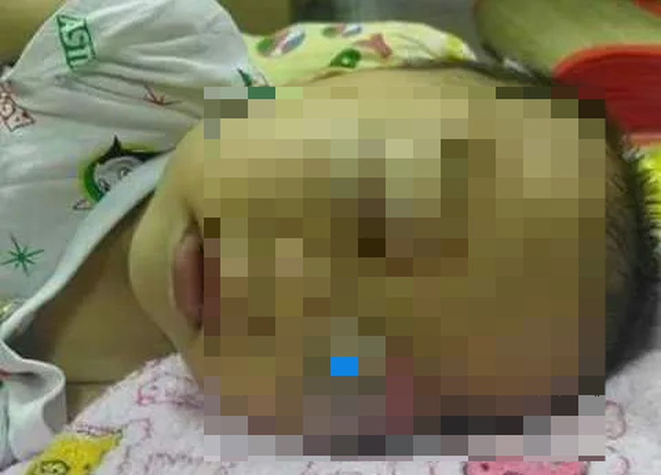 Xót xa cảnh cháu bé 3 tuổi quằn quại trong cơn đau vì ung thư quái ác hành hạ - 3