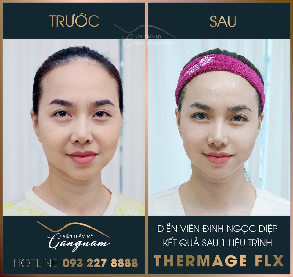 Những sao nữ xuyên không về thanh xuân chỉ sau 1 thời gian ngắn - 5 Những sao nữ xuyên không về thanh xuân chỉ sau 1 thời gian ngắn - 5