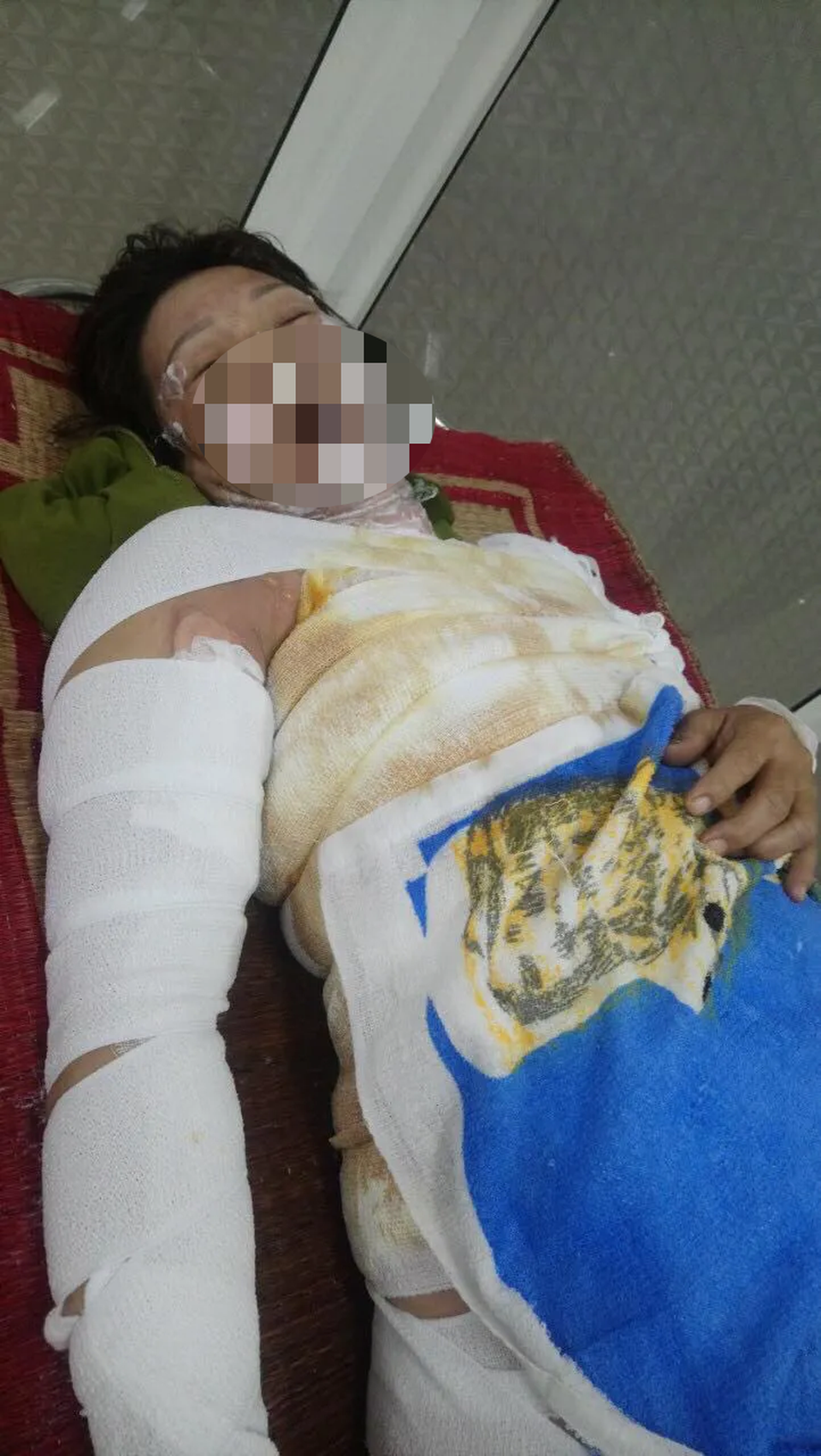 Nghi án người phụ nữ bị chồng hờ tưới xăng thiêu sống - 1 Nghi án người phụ nữ bị chồng hờ tưới xăng thiêu sống - 1