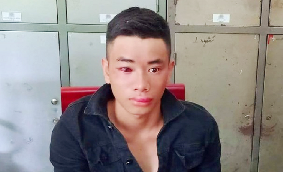 Thiếu úy công an bị “con nghiện” dùng kim tiêm đâm khi vây bắt - 1