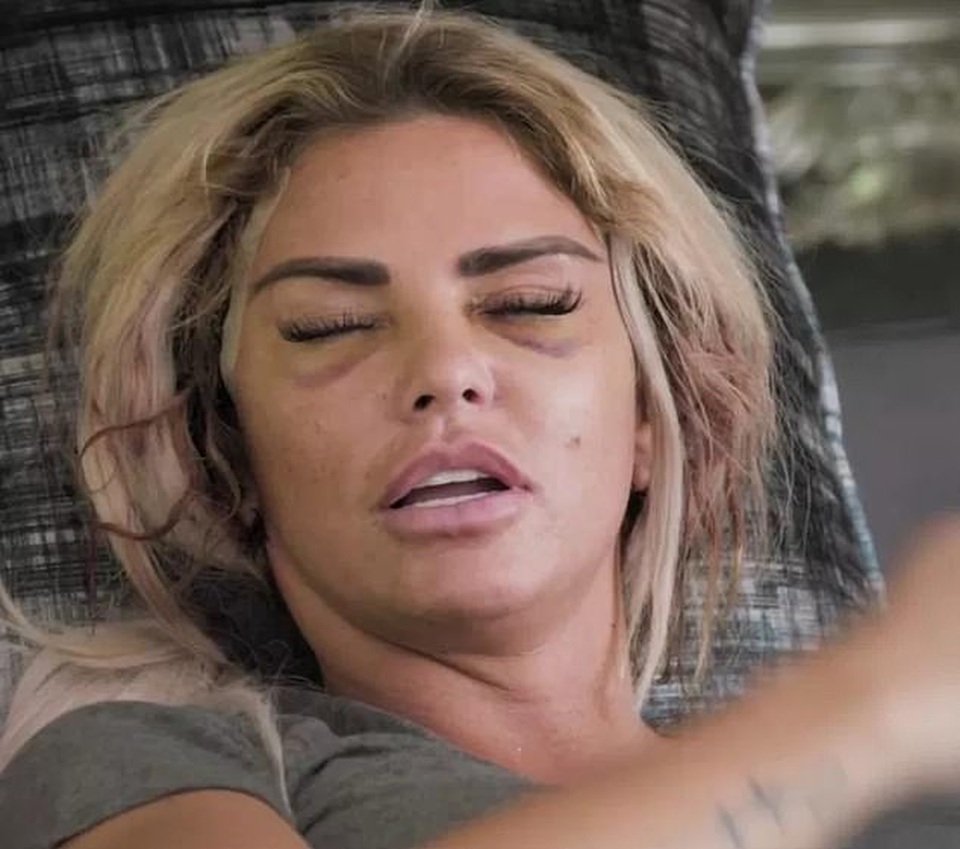 Katie Price tiếp tục làm đẹp bằng dao kéo - 1 Katie Price tiếp tục làm đẹp bằng dao kéo - 1