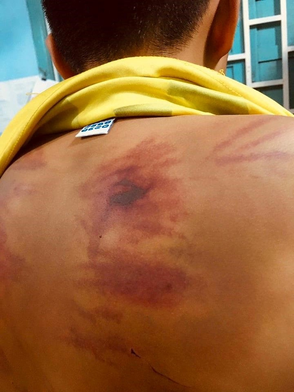 Bé trai 11 tuổi bị 1 người tu hành đánh dã man - 1 Bé trai 11 tuổi bị 1 người tu hành đánh dã man - 1