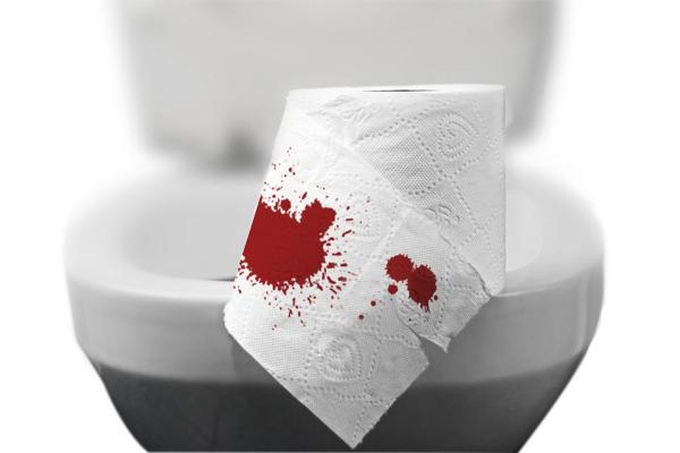 Hỗ trợ điều trị trĩ an toàn bằng Đông Y - 1 Hỗ trợ điều trị trĩ an toàn bằng Đông Y - 1