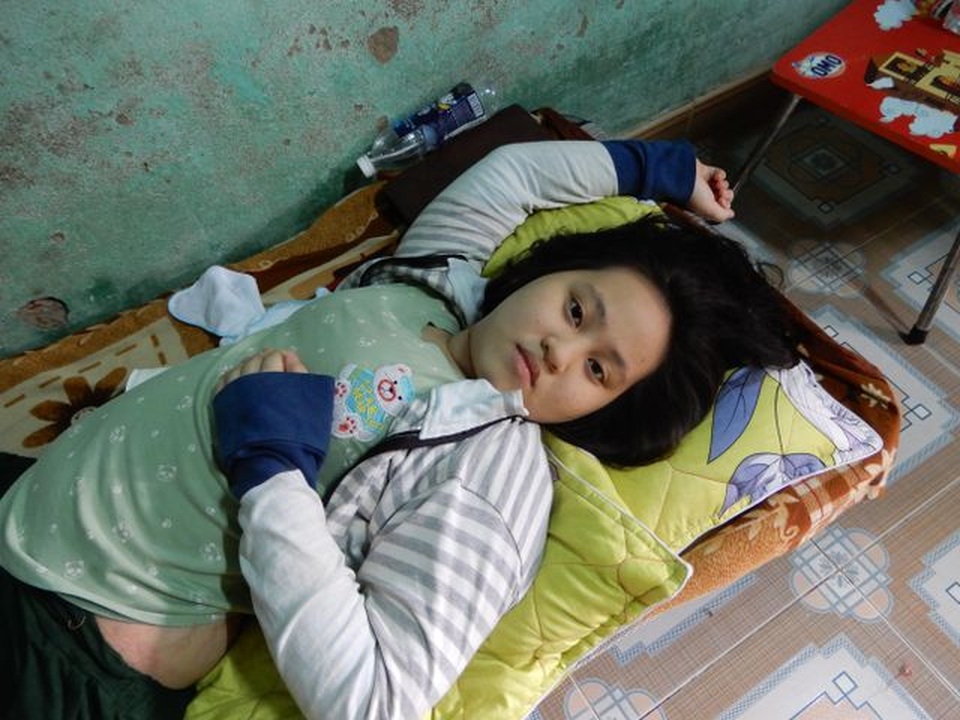 Bệnh u xương quái ác mang bé gái một chân đi mãi để lại những nỗi niềm day dứt cho bạn đọc Dân trí - 1 Bệnh u xương quái ác mang bé gái một chân đi mãi để lại những nỗi niềm day dứt cho bạn đọc Dân trí - 1