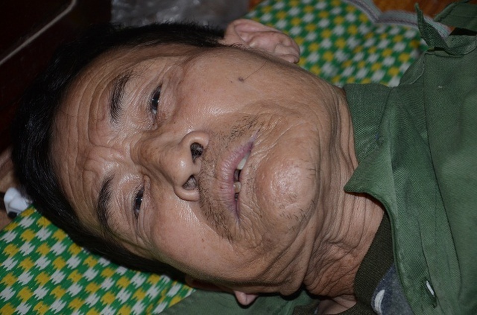 Người cựu binh ung thư khốn khổ nuôi con trai tâm thần và mẹ già 90 tuổi - 3 Người cựu binh ung thư khốn khổ nuôi con trai tâm thần và mẹ già 90 tuổi - 3