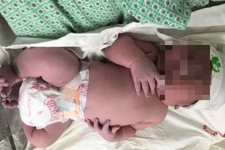 Bác sĩ ngỡ ngàng khi bé trai bụ bẫm vừa chào đời đã nặng... 5,2kg - 1 Bác sĩ ngỡ ngàng khi bé trai bụ bẫm vừa chào đời đã nặng... 5,2kg - 1