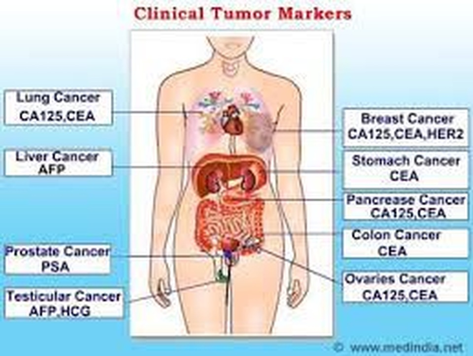 CancerSEEK: “Sinh thiết lỏng” chẩn đoán sớm ung thư - 3 CancerSEEK: “Sinh thiết lỏng” chẩn đoán sớm ung thư - 3