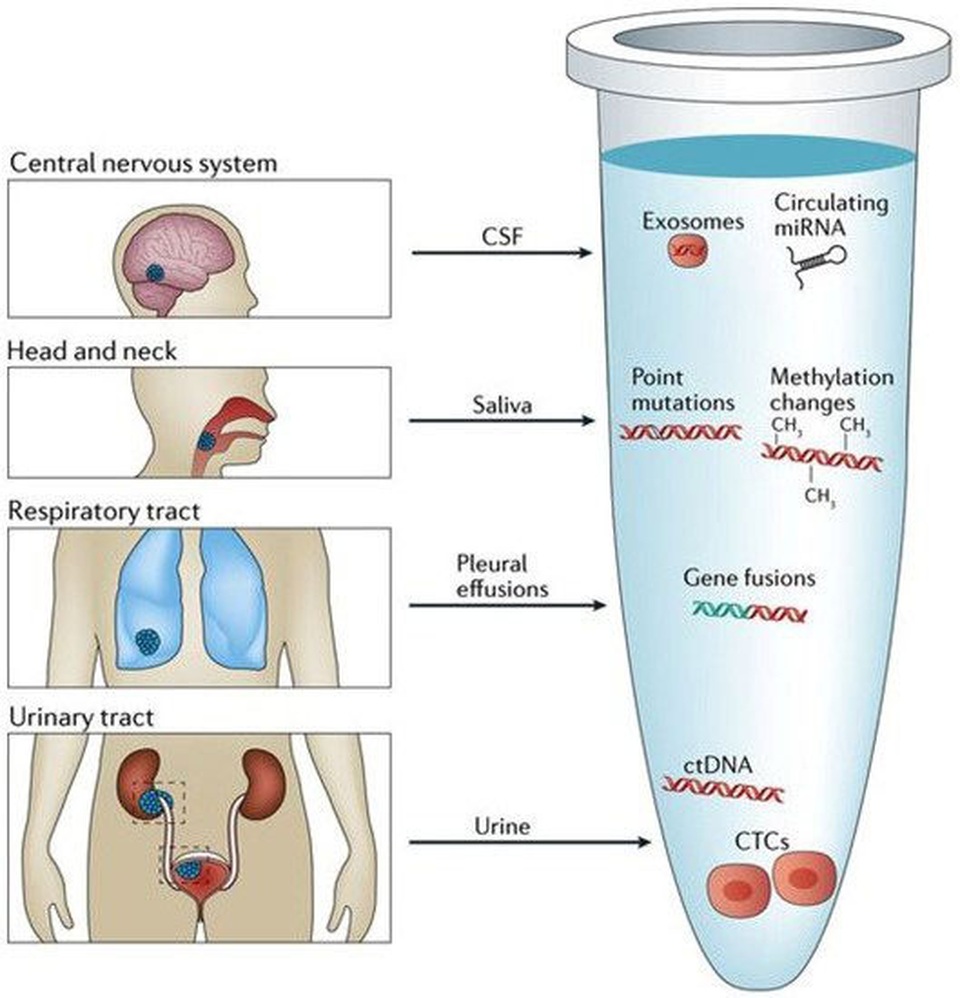 CancerSEEK: “Sinh thiết lỏng” chẩn đoán sớm ung thư - 5 CancerSEEK: “Sinh thiết lỏng” chẩn đoán sớm ung thư - 5