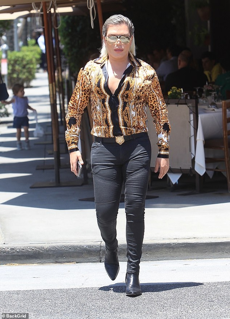 Sao nghiện dao kéo Rodrigo Alves hóa tiên cá - 5 Sao nghiện dao kéo Rodrigo Alves hóa tiên cá - 5