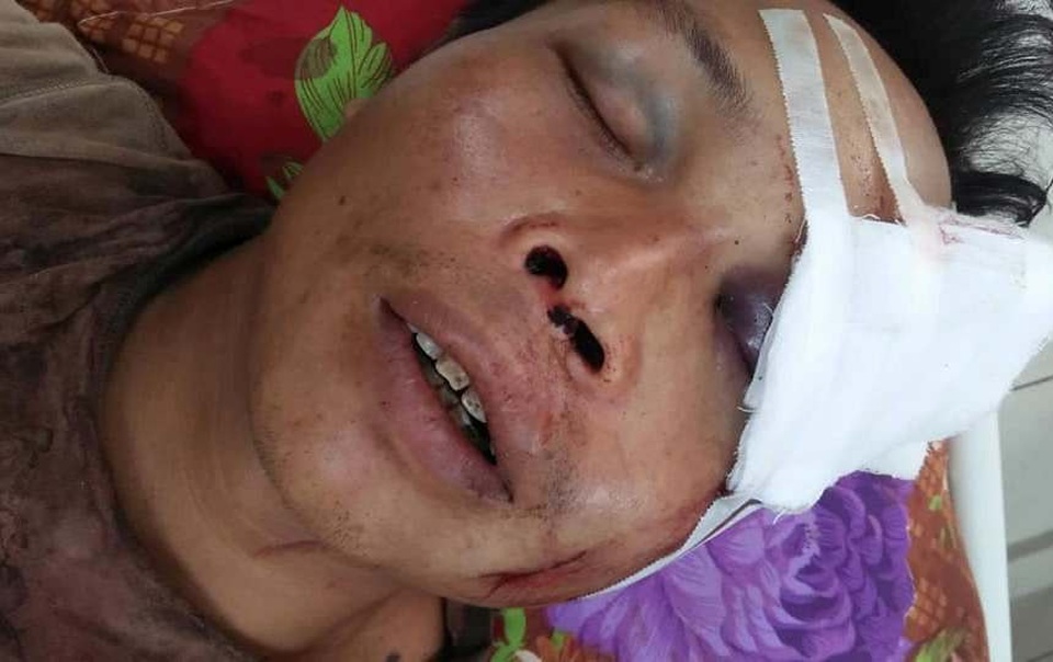 Xót cảnh phận đời 5 đứa trẻ nheo nhóc còn bố mẹ mà... sống như trẻ mồ côi - 1 Xót cảnh phận đời 5 đứa trẻ nheo nhóc còn bố mẹ mà... sống như trẻ mồ côi - 1