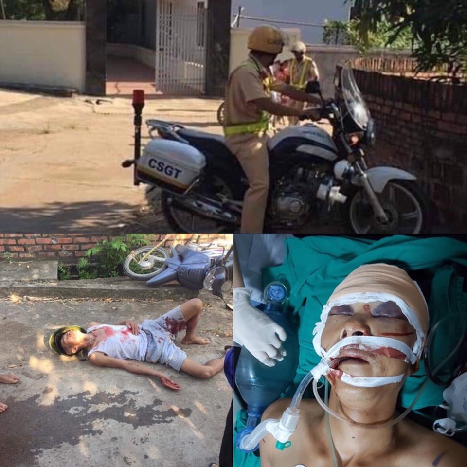 Xác minh thông tin CSGT truy đuổi khiến người vi phạm ngã chấn thương sọ não - 1 Xác minh thông tin CSGT truy đuổi khiến người vi phạm ngã chấn thương sọ não - 1