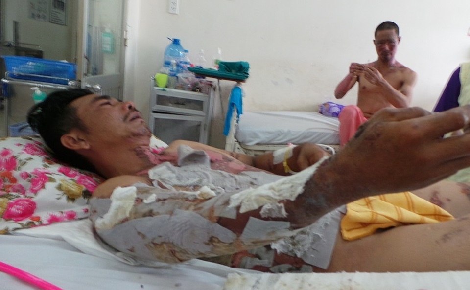 Câu cá dưới đường điện, cần thủ bị bỏng nặng - 2