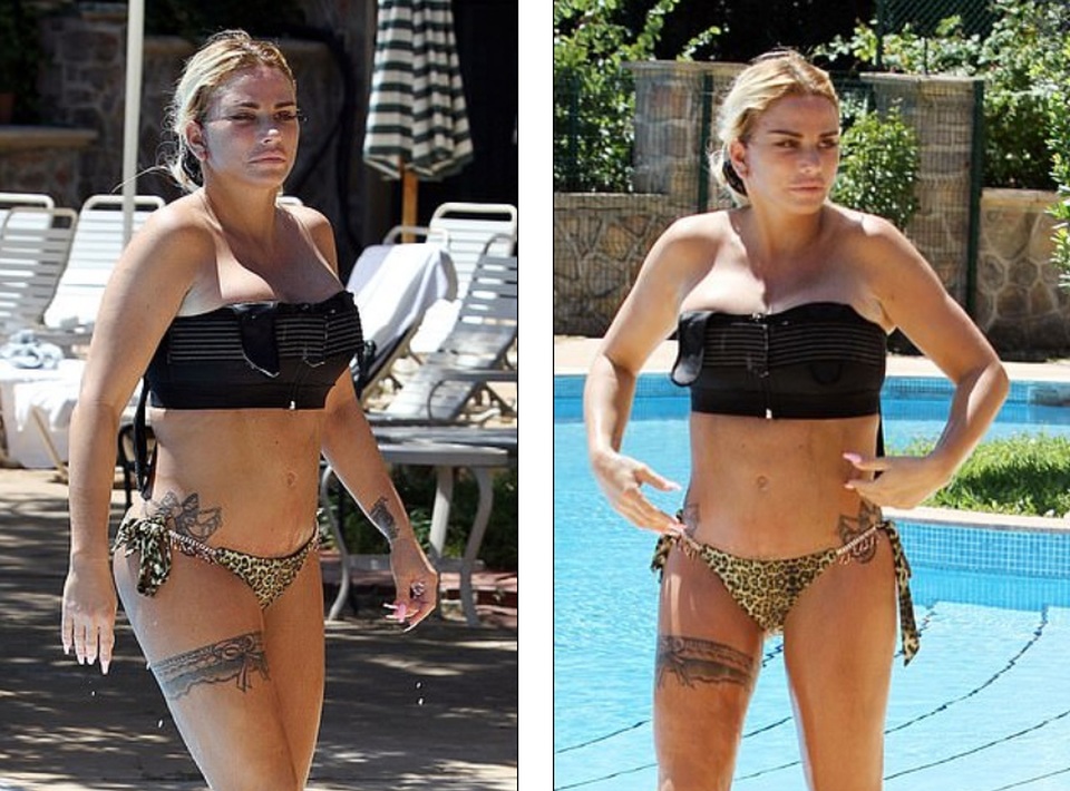 Hoảng sợ với gương mặt sau phẫu thuật thẩm mỹ của Katie Price - 6 Hoảng sợ với gương mặt sau phẫu thuật thẩm mỹ của Katie Price - 6
