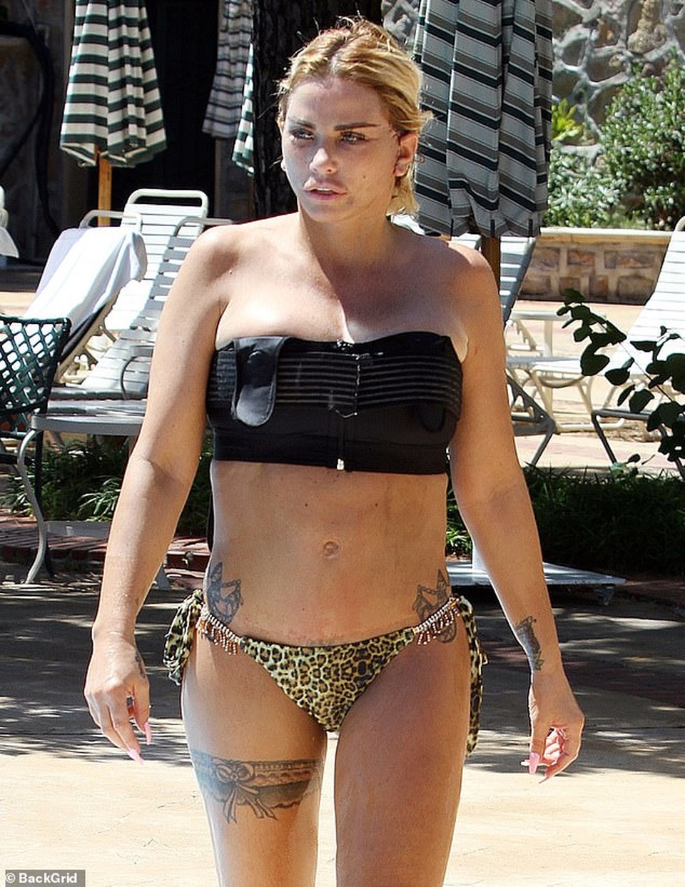 Hoảng sợ với gương mặt sau phẫu thuật thẩm mỹ của Katie Price - 3 Hoảng sợ với gương mặt sau phẫu thuật thẩm mỹ của Katie Price - 3