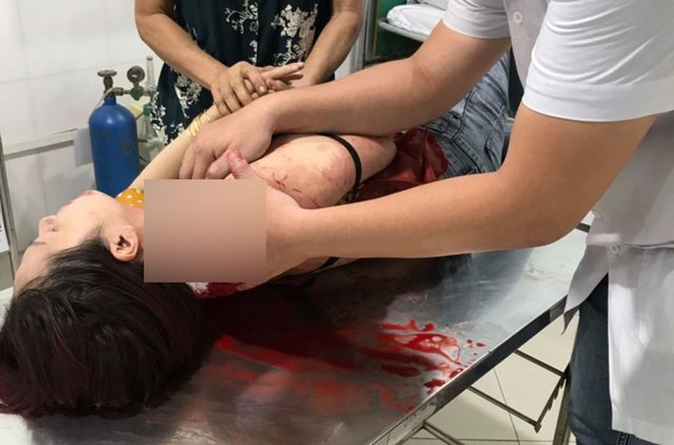 Vụ một phụ nữ bị đâm khi vừa ăn sáng xong: Nghi can ra đầu thú - 2