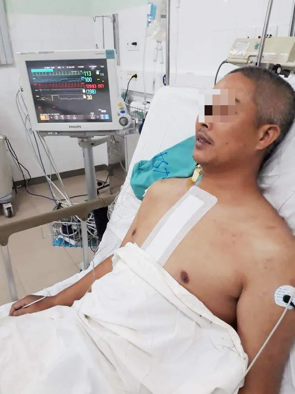 Bệnh nhân hồi phục thần tốc sau ca ghép tim thành công - 5 Bệnh nhân hồi phục thần tốc sau ca ghép tim thành công - 5