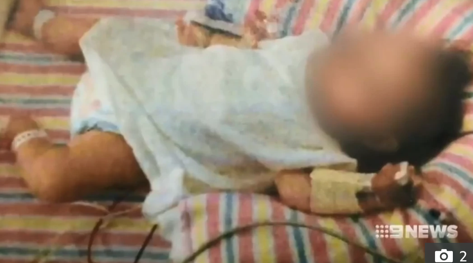 Vợ chồng ăn chay để con 20 tháng tuổi nặng chưa đến 5kg, còi xương và không mọc nổi răng - 1 Vợ chồng ăn chay để con 20 tháng tuổi nặng chưa đến 5kg, còi xương và không mọc nổi răng - 1