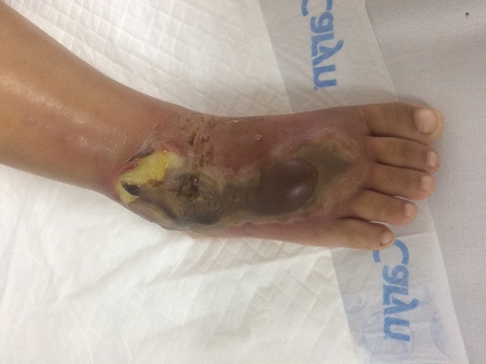 Bé gái 3 tuổi bị rắn hổ mang tấn công khi đang xem tivi - 1