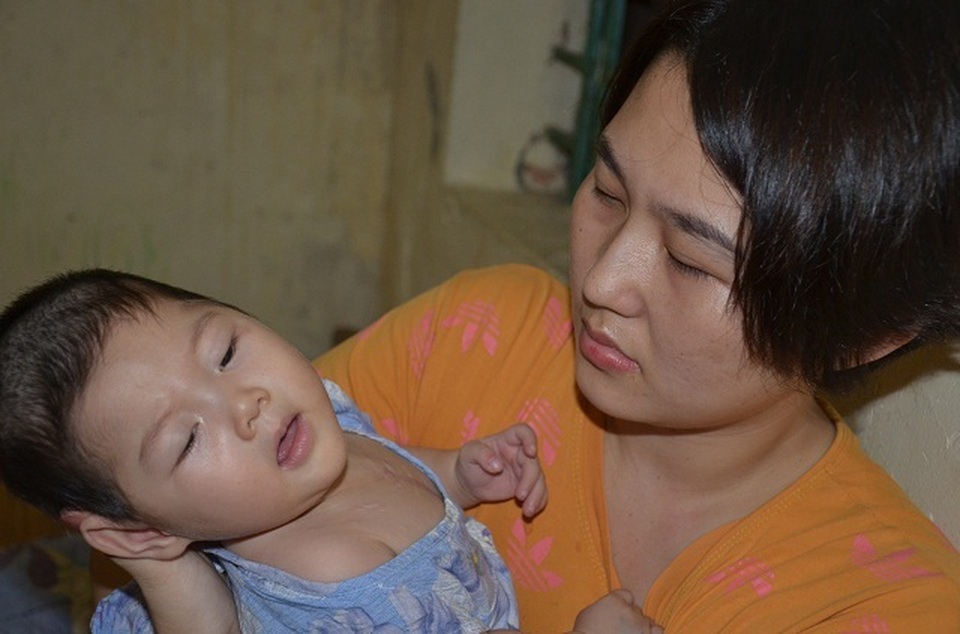 Tiếng khóc xé lòng của bé gái 9 tháng tuổi mắc tim bẩm sinh phức tạp - 7 Tiếng khóc xé lòng của bé gái 9 tháng tuổi mắc tim bẩm sinh phức tạp - 7