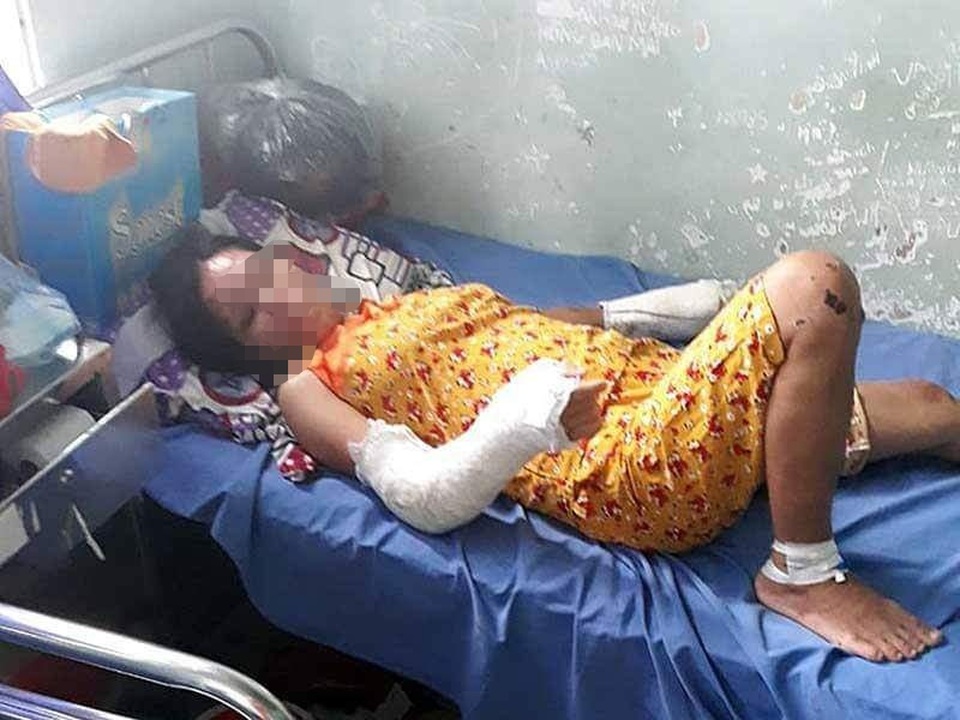 Phẫn nộ người chồng đánh đập tàn bạo vợ đang mang thai 7 tháng - 5 Phẫn nộ người chồng đánh đập tàn bạo vợ đang mang thai 7 tháng - 5