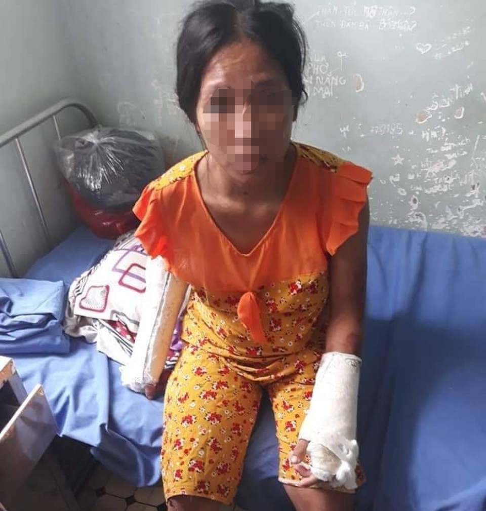 Phẫn nộ người chồng đánh đập tàn bạo vợ đang mang thai 7 tháng - 1 Phẫn nộ người chồng đánh đập tàn bạo vợ đang mang thai 7 tháng - 1