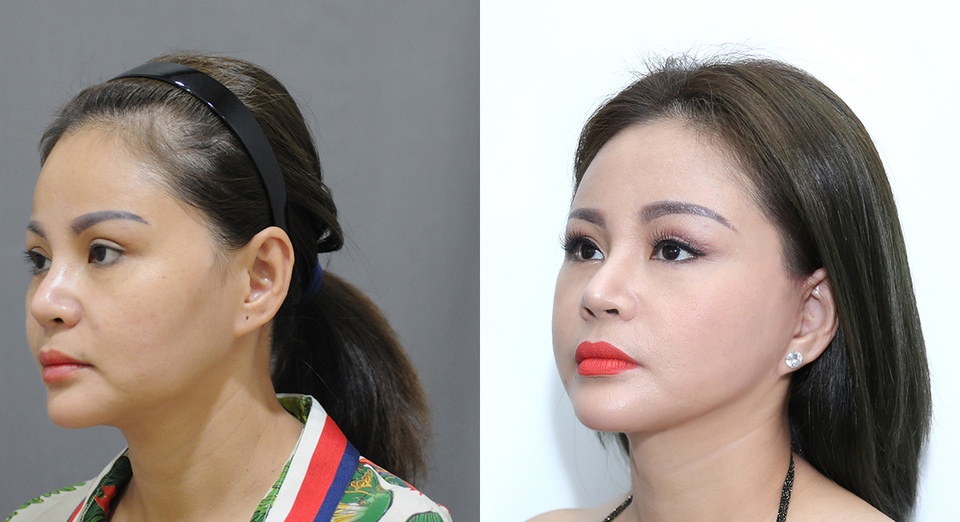 Lê Giang 18 năm miệt mài “dao kéo” khiến con trai lo “có ngày không nhận ra mẹ” - 15 Lê Giang 18 năm miệt mài “dao kéo” khiến con trai lo “có ngày không nhận ra mẹ” - 15