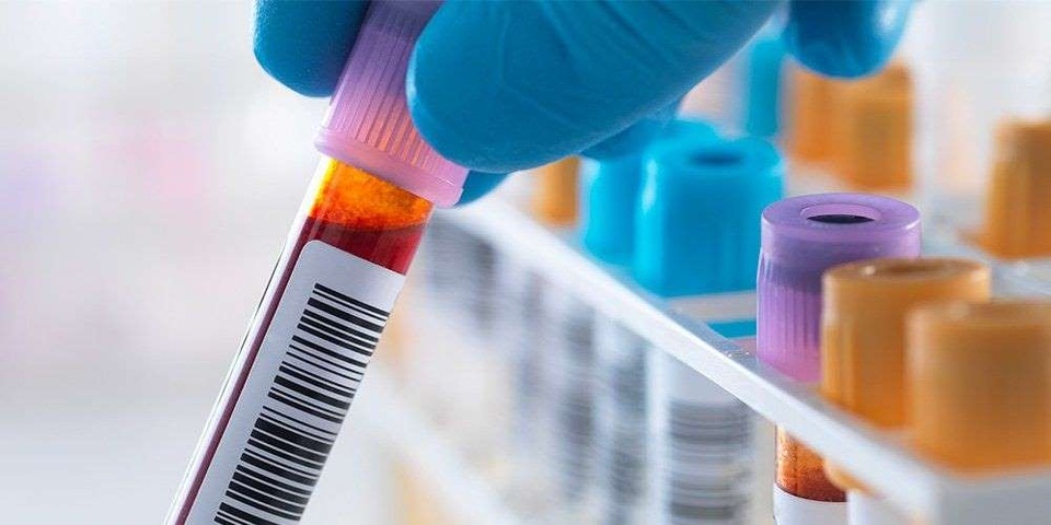 5 câu nên hỏi về kết quả xét nghiệm máu - 1 5 câu nên hỏi về kết quả xét nghiệm máu - 1