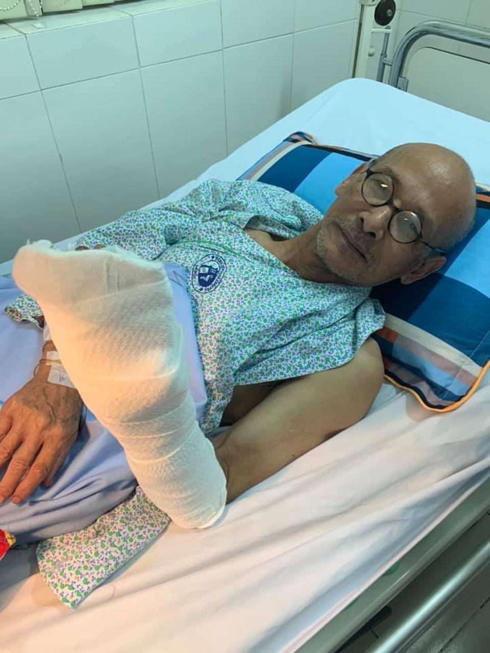Nhà văn Nguyễn Văn Thọ bị cưa điện “xén” đứt lìa nửa bàn tay trái - 1 Nhà văn Nguyễn Văn Thọ bị cưa điện “xén” đứt lìa nửa bàn tay trái - 1