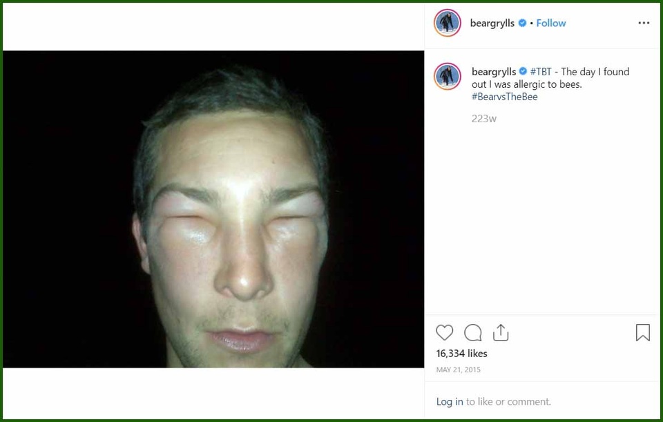 Chuyên gia sinh tồn Bear Grylls suýt mất mạng vì… ong đốt - 3 Chuyên gia sinh tồn Bear Grylls suýt mất mạng vì… ong đốt - 3