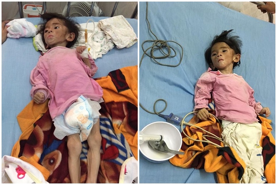 Sự thay đổi bất ngờ của em bé suy dinh dưỡng Lào Cai sau khi được nhận nuôi - 1