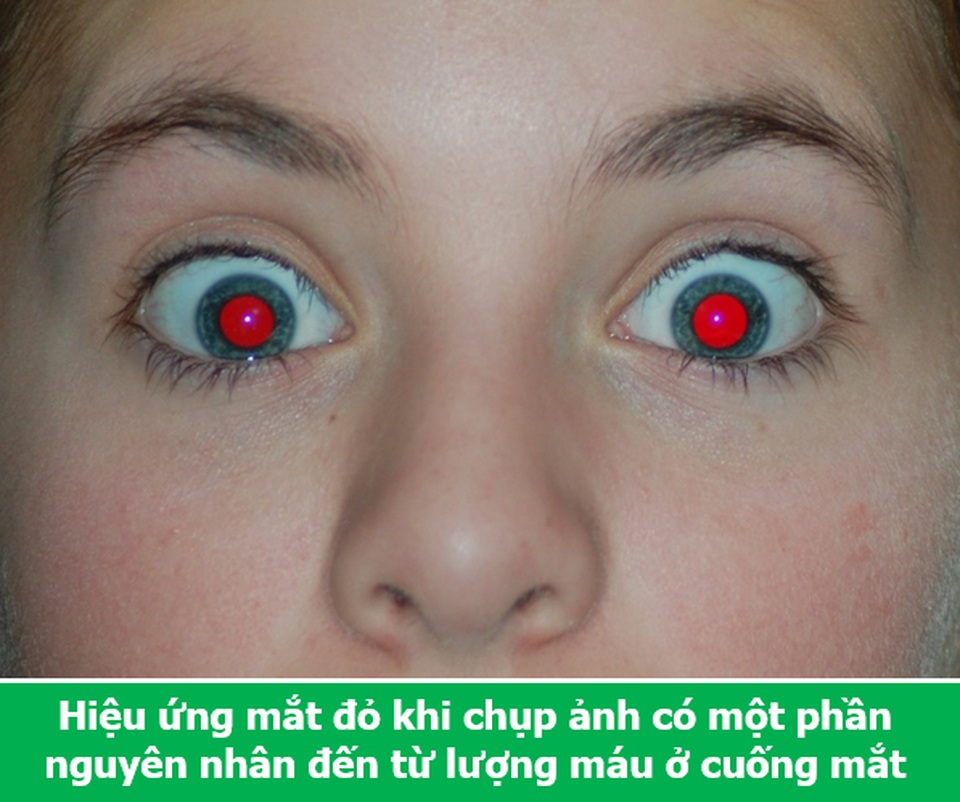 Loạt sự thật thú vị giải đáp những thắc mắc muôn thuở của chính bạn! - 5 Loạt sự thật thú vị giải đáp những thắc mắc muôn thuở của chính bạn! - 5
