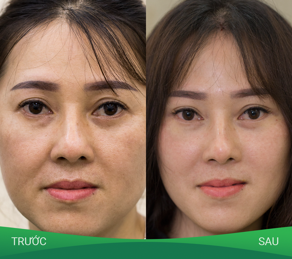 Lựa chọn hàng đầu của Ngôi sao không tuổi MC Nguyễn Cao Kỳ Duyên - 1 Lựa chọn hàng đầu của Ngôi sao không tuổi MC Nguyễn Cao Kỳ Duyên - 1
