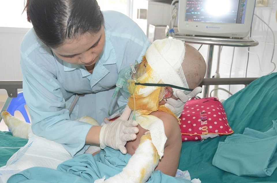 Lạnh người nhìn cậu bé như ngọn đuốc bởi vụ hoả hoạn bất thường! - 4 Lạnh người nhìn cậu bé như ngọn đuốc bởi vụ hoả hoạn bất thường! - 4