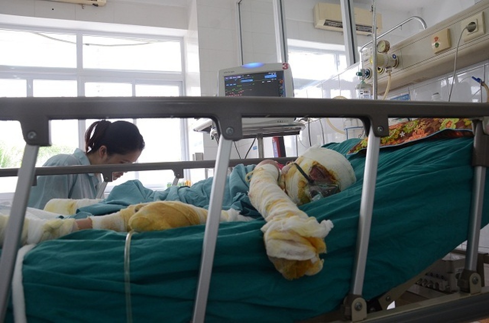 Lạnh người nhìn cậu bé như ngọn đuốc bởi vụ hoả hoạn bất thường! - 8 Lạnh người nhìn cậu bé như ngọn đuốc bởi vụ hoả hoạn bất thường! - 8