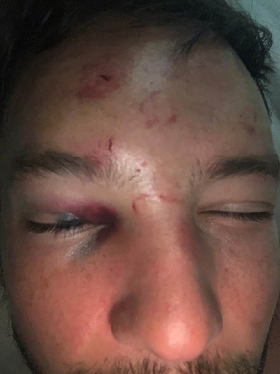 Gạ gẫm “hoa đã có chủ”, hàng thảicủa Chelsea bị đánh bầm dập - 1