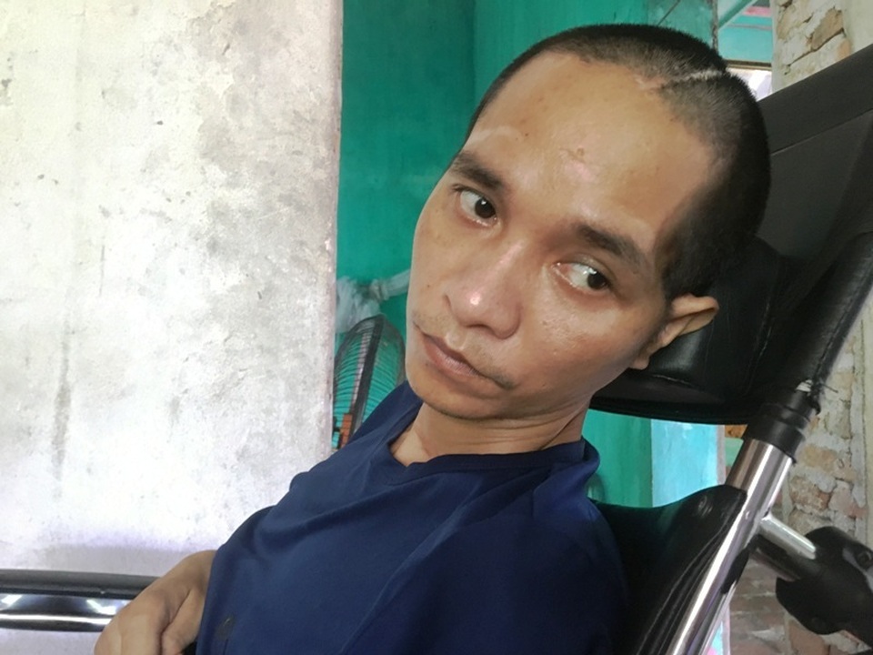 Xót thương đôi bàn tay thô ráp của người em cắn răng chăm anh bệnh tật - 6 Xót thương đôi bàn tay thô ráp của người em cắn răng chăm anh bệnh tật - 6