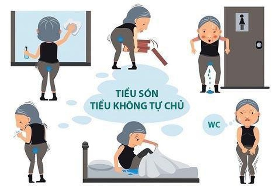 Có thực phẩm bảo vệ sức khỏe Ích Tiểu Vương, không lo tiểu són “làm phiền” - 1 Có thực phẩm bảo vệ sức khỏe Ích Tiểu Vương, không lo tiểu són “làm phiền” - 1