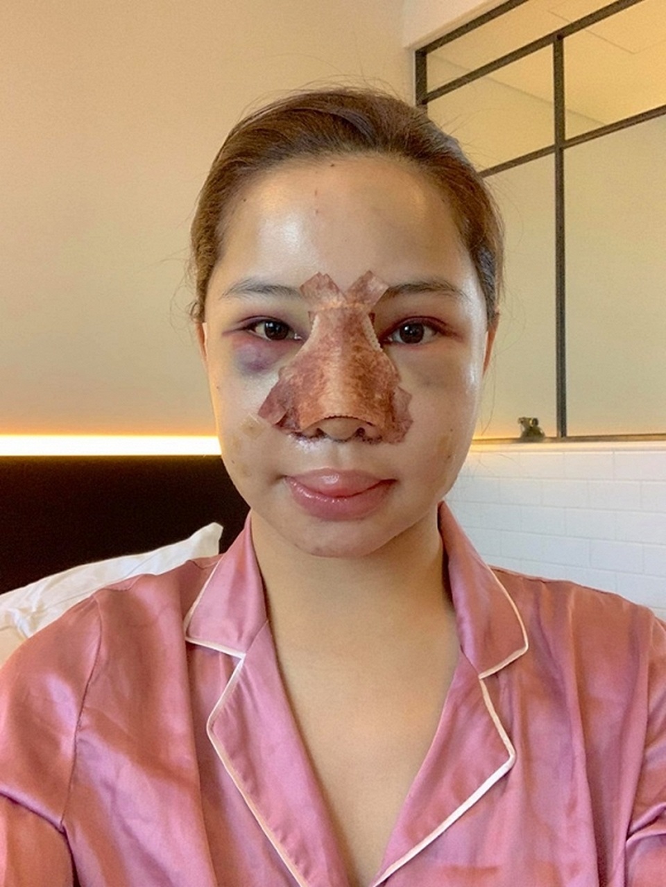 Lưu Đê Ly gây sửng sốt khi công khai quá trình “đập mặt xây lại” - 5 Lưu Đê Ly gây sửng sốt khi công khai quá trình “đập mặt xây lại” - 5